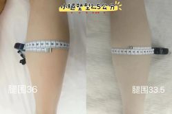 -Lily纤美·科技减脂中心