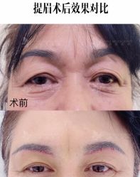 -圣嘉新医疗美容医院