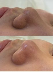 -SOS修丽可.痘肌修复中心