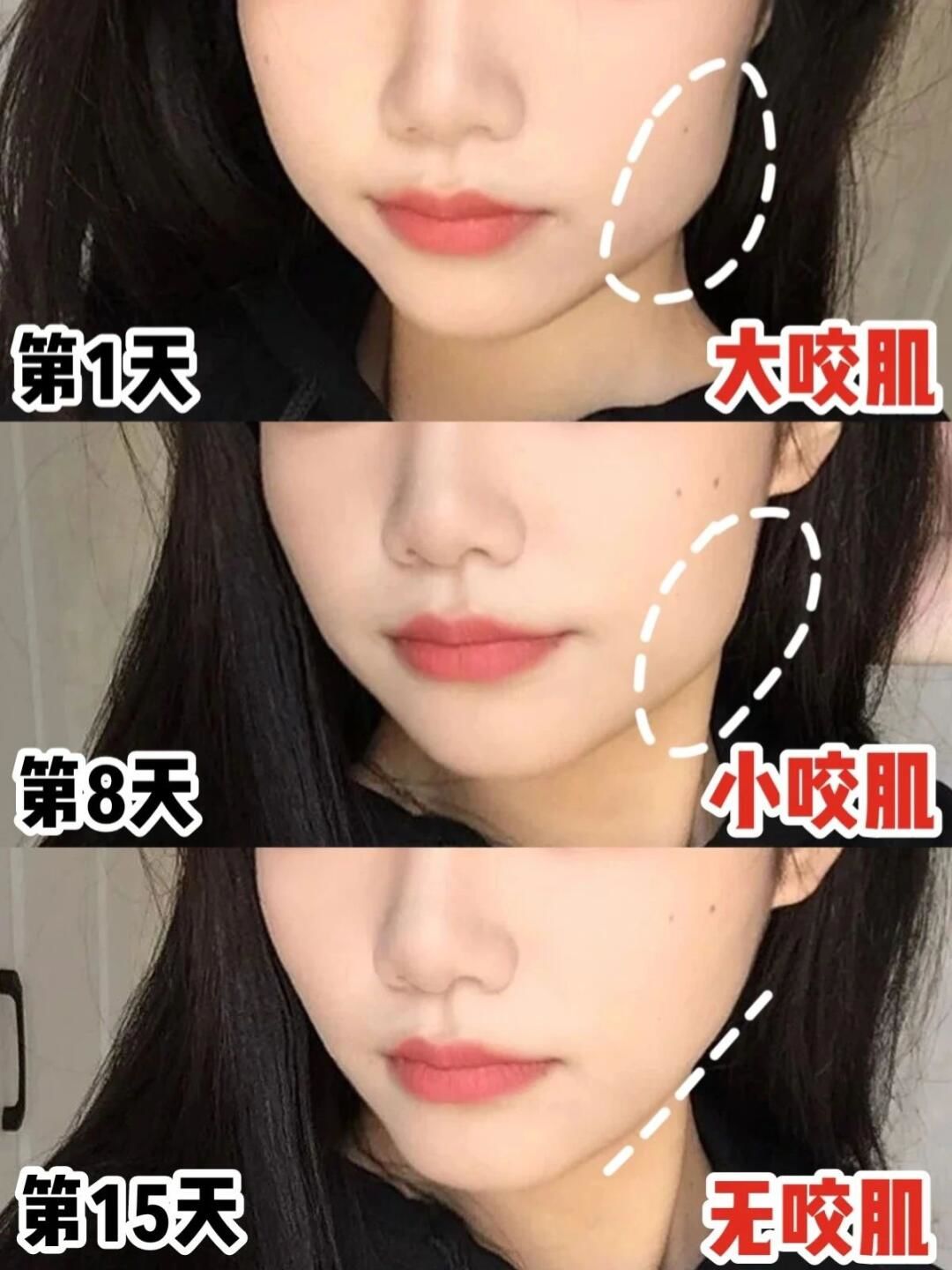 为什么瘦脸针不能马上见效百科在线 为什么瘦脸针不能马上见效百科在线