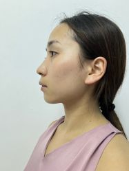-四川米兰柏羽医学美容医院