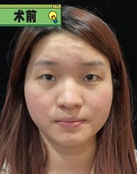 -素美医疗美容·西南眼鼻整形·修复基地