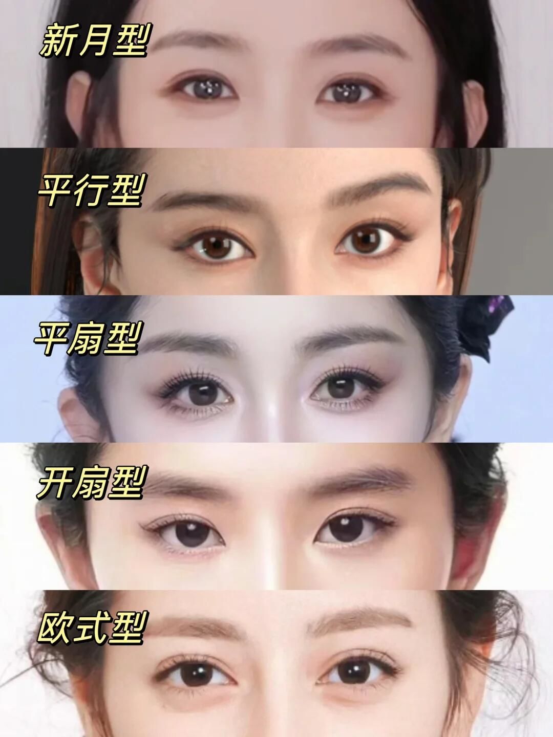 双眼皮类型大选择