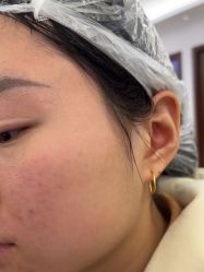 -长沙雅美医疗美容医院