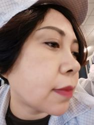 体验后-天津健丽·去眼袋医疗美容机构