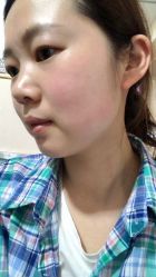 点击看大图 -北京美痣堂古方祛痣斑疣瘊