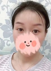 -南京健丽·去眼袋医疗美容机构