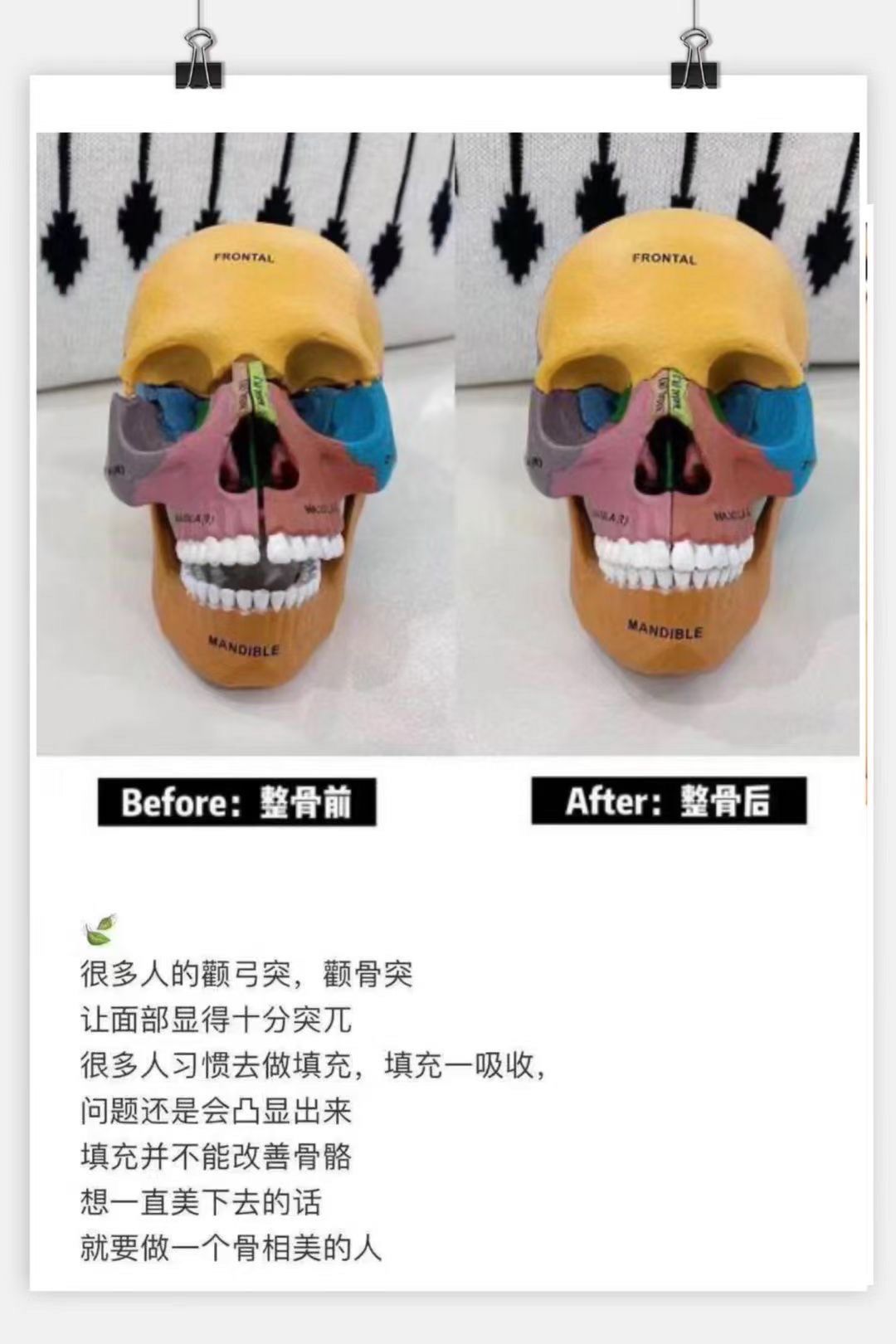 你知道小颜整骨的必要性在哪吗?