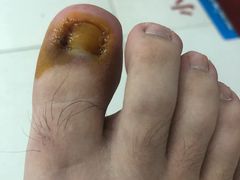 -新甲连锁灰指甲·甲沟炎·鸡眼(黑龙江路店)