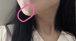 -深圳艺星医疗美容医院