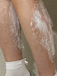 -海涛医疗美容·面部抗衰·注射美鼻