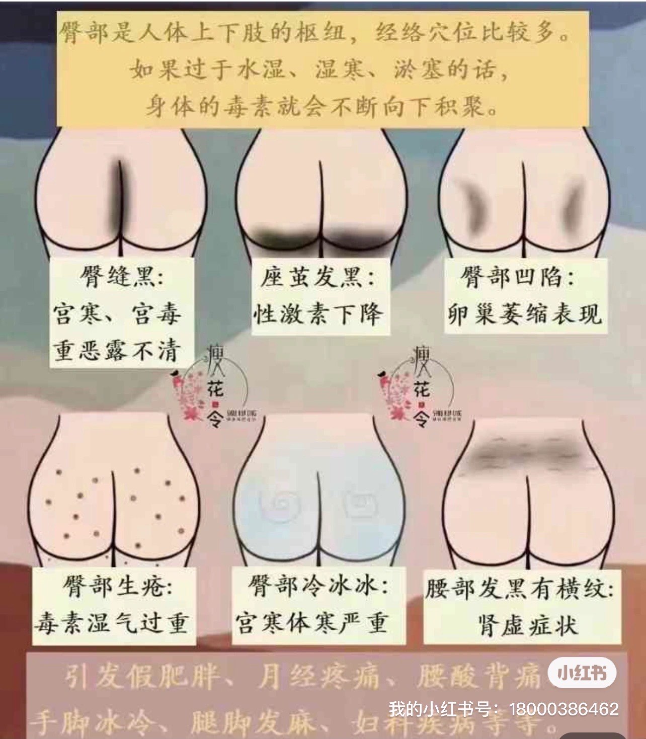 屁股上有痣的命运图解图片