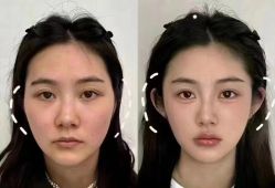 -Yestar 嘉兴艺星医疗美容医院