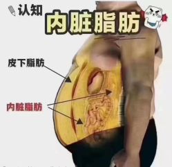 -香薇妮丝女子减肥院