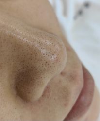 -悦瑢港湾科技美肤芳疗美容