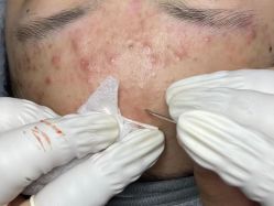 -Cream88颜皮肤管理中心