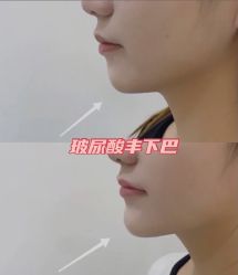 -上海漾颜医疗美容