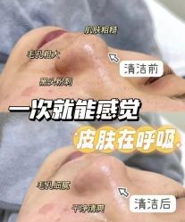 -春田皮肤管理中心品牌旗舰店