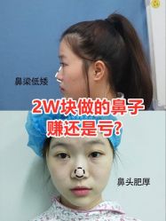 点击看大图 -Yestar宁波艺星整形医院