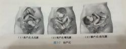 -昕孕瑜伽·孕妇瑜伽·产后修复