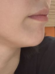 -广州美莱医疗美容医院