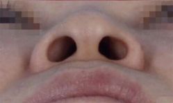 -南宁华美医疗美容医院