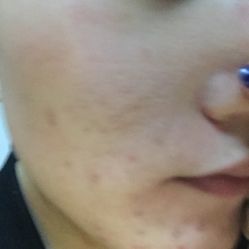 点击看大图 -MedSkinCare科技祛痘肌肤修护中心