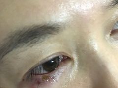 -南昌大学附属眼科医院(东湖院区)