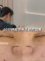 -BELLAREAL新美社