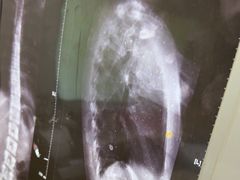 -张钰强中医正骨推拿连锁(华发商都店)