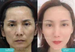 -AIST爱思特医疗美容医院