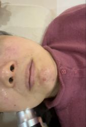 -长沙雅美医疗美容医院