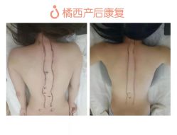 -橘西产后康复中心