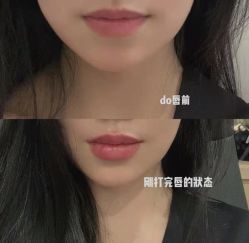 -上海漾颜医疗美容