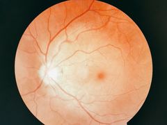 -宝岛眼镜(常熟珠江路欧尚店)