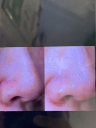 -苑苑vbeauty科技美容SPA