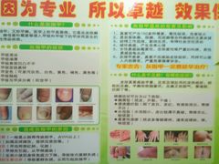 android_upload_pic-祖传修脚甲沟炎灰指甲鸡眼