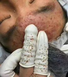 -痘敏医生专业祛痘·肌肤修复连锁