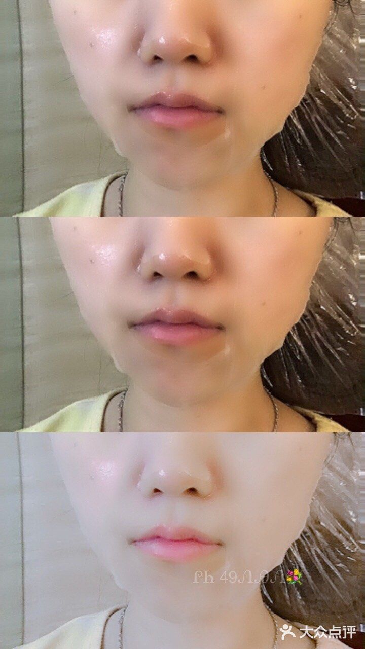 Mediheal含针剂补水精华的面膜