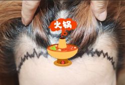 -大麦微针植发全国连锁