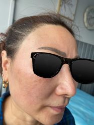 -爱莎扁平疣·汗管瘤·斑痣中心