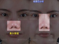 -北京米扬丽格医疗美容·联合丽格鼻整形中心