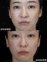 -Yestar重庆艺星医疗美容医院