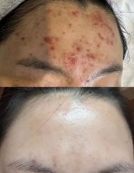 -SOS修丽可.痘肌修复中心