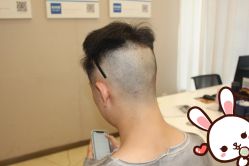 点击看大图 -大麦微针植发丨全国连锁