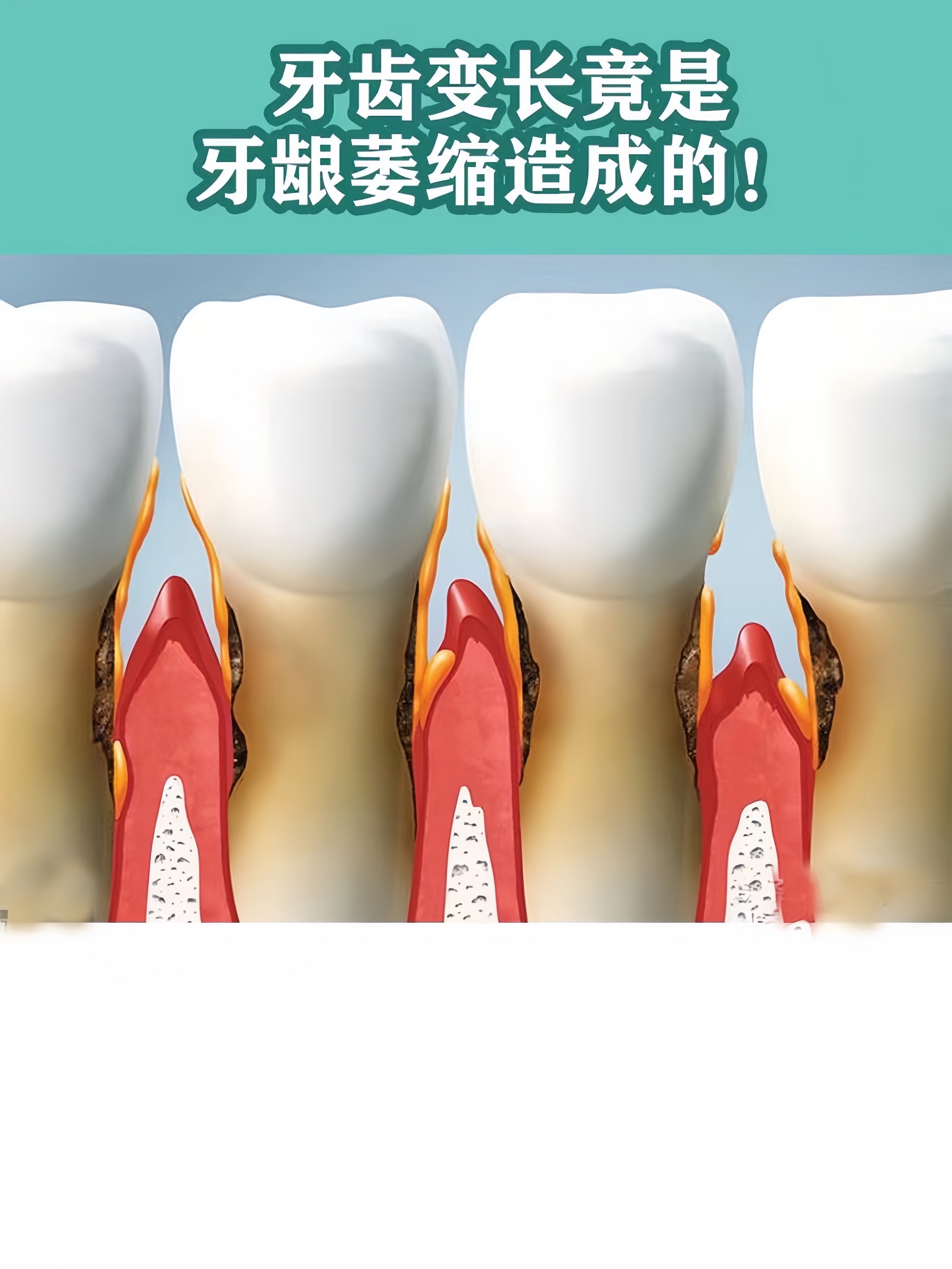 牙齿很长图片