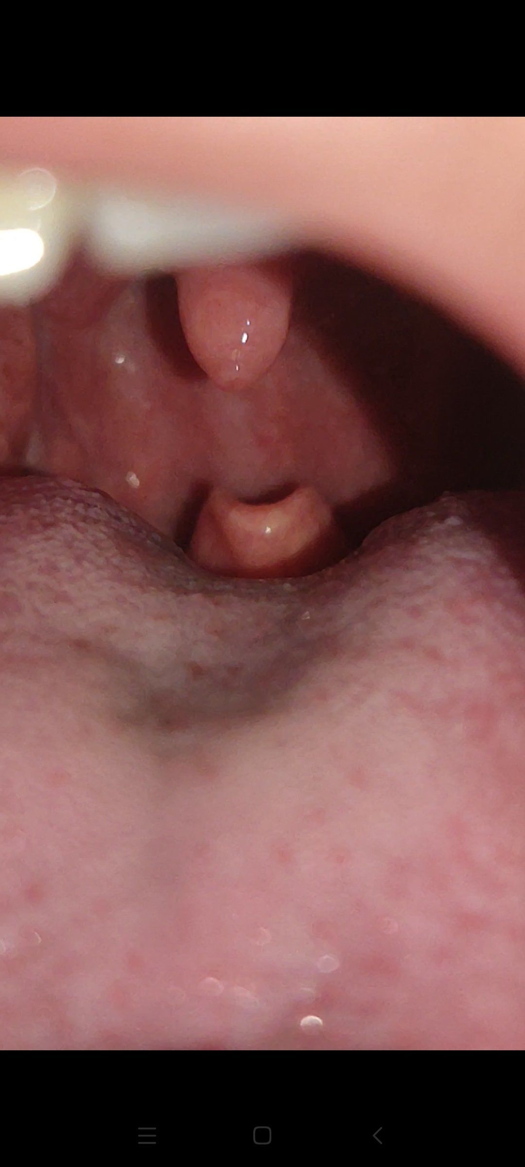 舌头后面有个舌头正常么?