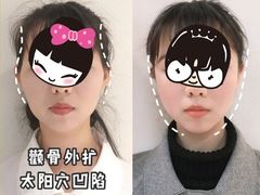 -团圆口腔·种植中心(锦江院区)