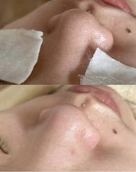 -禾壹净·素颜美问题肌肤修护中心