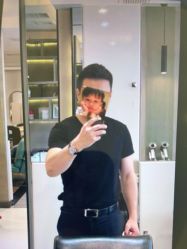 -大麦微针植发丨全国连锁